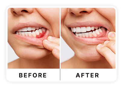 PROTECTED teeth and gums.